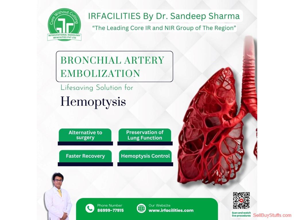 Chandigarh Procedure BAE: Safe Solution for Treating Pulmonary Hemorrhage