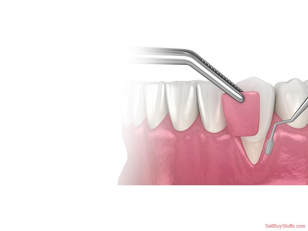 Mumbai Advanced Gum Care at Agrawal Dental Clinic