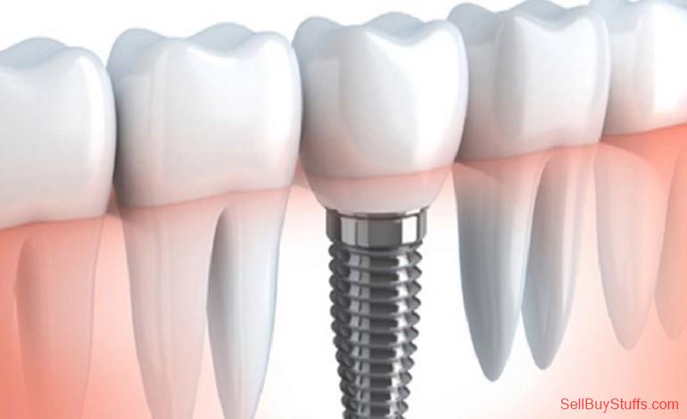 Mumbai High Quality Dental Implants in India