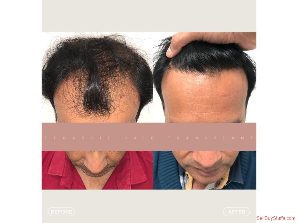 Indore Classifieds Best Hair Treatment in Indore | Expert Hair Care & Regrowth Solutions Australia Classifieds Best Hair Treatment in Indore | Expert Hair Care & Regrowth Solutions