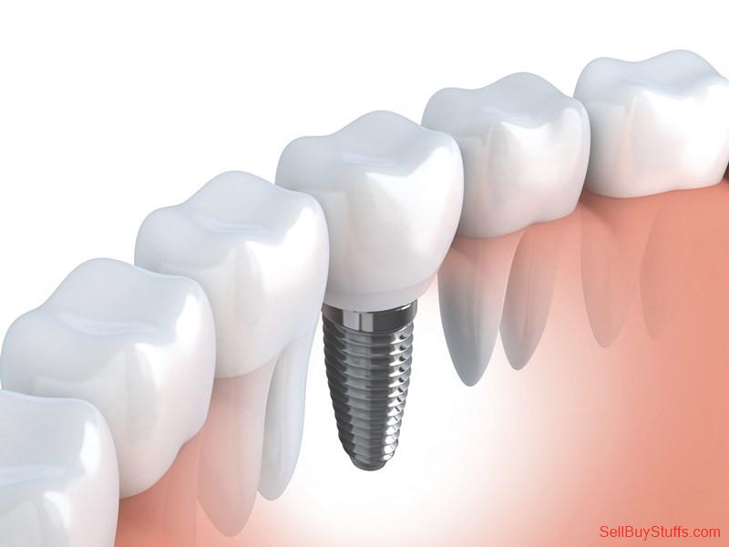 Mumbai Classifieds Dental Implants in India Australia Classifieds Dental Implants in India