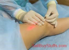 Pune Understanding Varicose Veins Treatment Cost in Pune